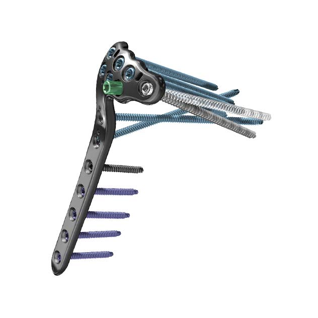 Alps Tibia Proximal Tibia proximal placa ALPS